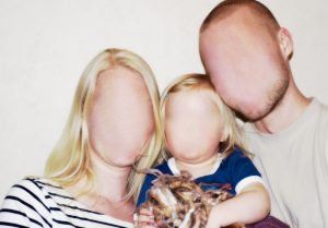 Prosopagnosia